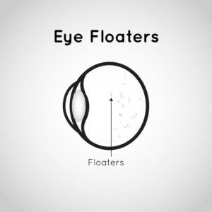 Eye Floaters symbol vector icon design illustration