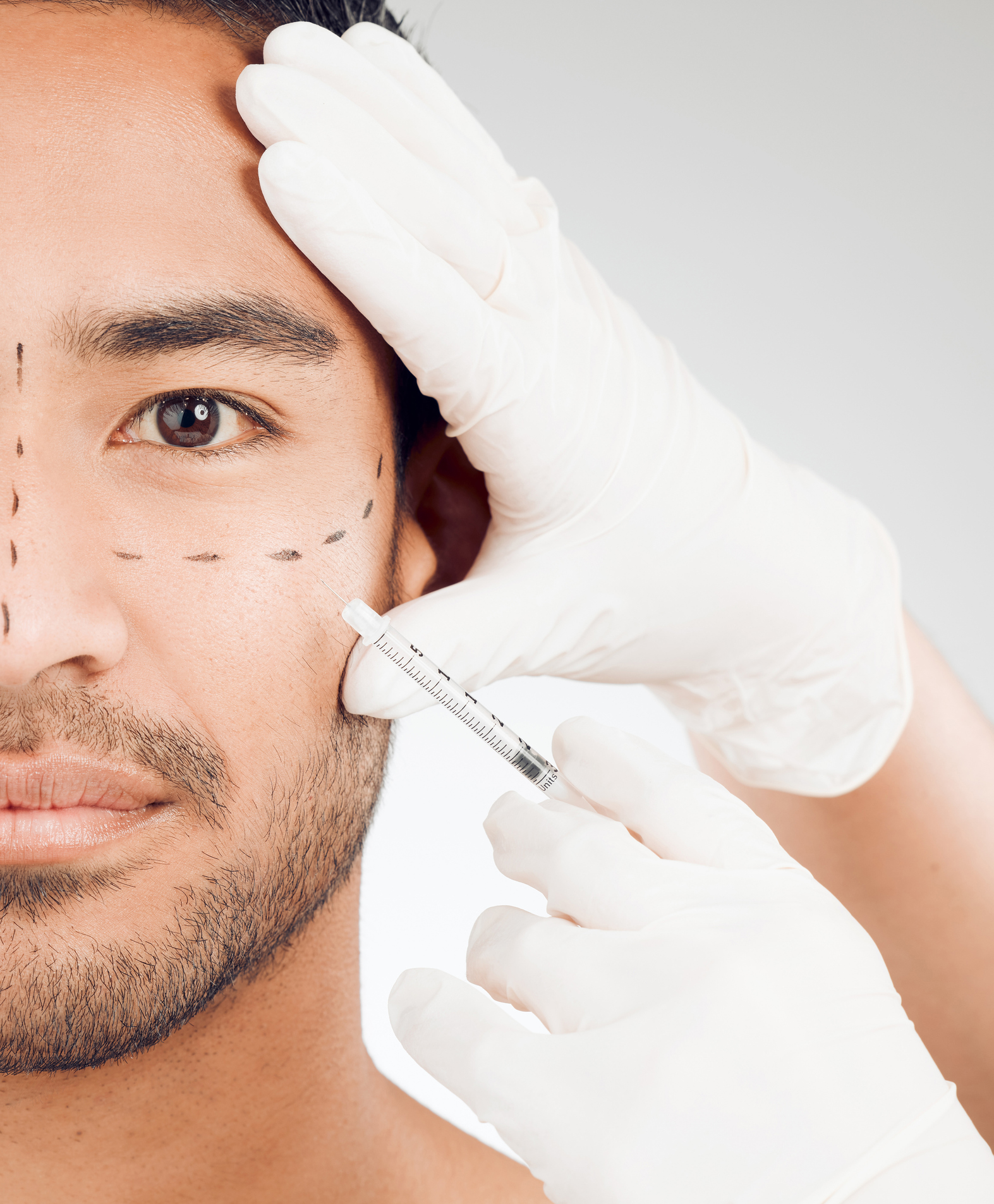 Studio shot of a handsome young man getting his face marked by gloved hands while posing against a grey background while receiving botox under eyes injection